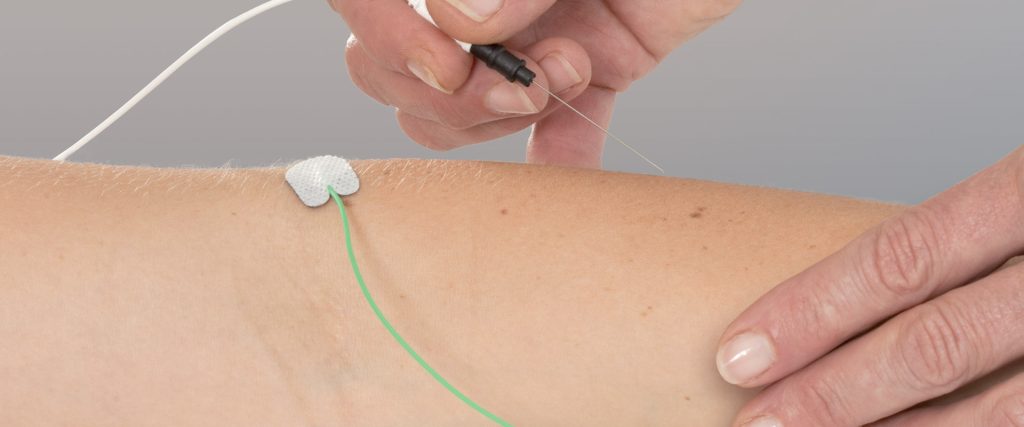 EMG / Neurodiagnostics